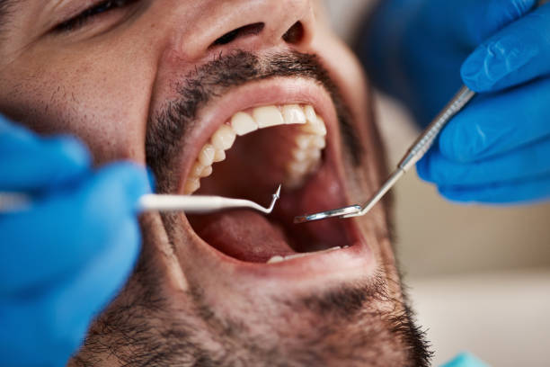 Best Cracked Tooth Emergency Dentist  in Crawfordville, FL